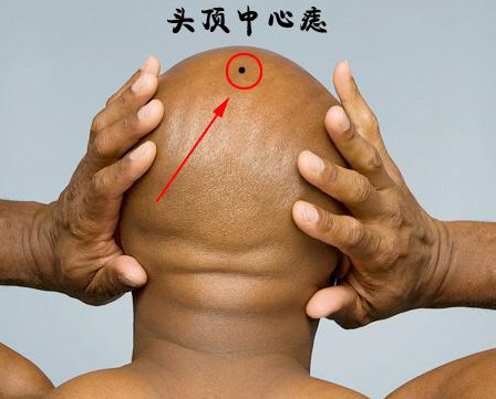 头顶长痣的人一生富贵,贵人运旺