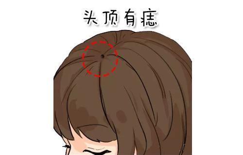 头顶长痣的人一生富贵,贵人运旺