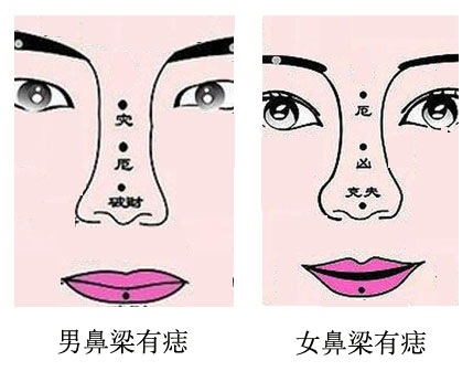 山根鼻梁上有痣的面相真的会影响婚姻吗?