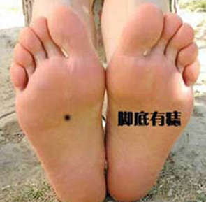 男人右脚底有痣代表什么?