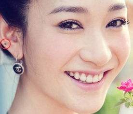 女人耳朵长痣命运好不好