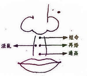 人中有痣好不好 人中有痣好不好