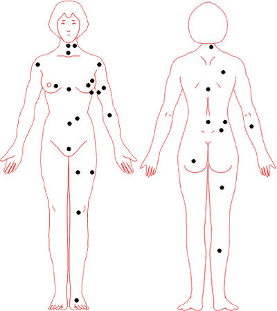 女人全身痣相图解 女人全身痣相图解