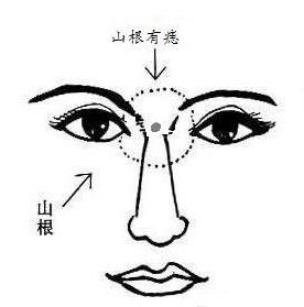 鼻子上有痣怎么看 鼻子上有痣怎么看