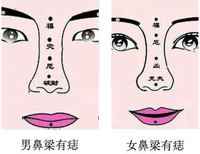 鼻子上有痣怎么看 鼻子上有痣怎么看