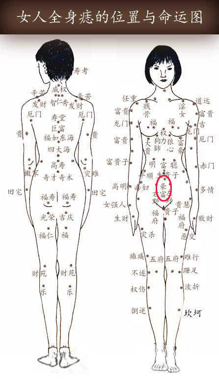 豪富痣 豪富痣
