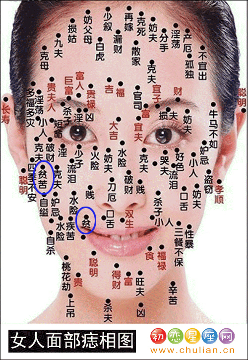 贫苦痣 贫苦痣