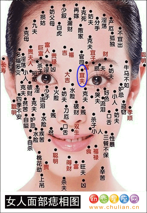 宜夫痣 宜夫痣