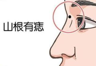 鼻子周围有痣好不好,鼻子上的痣看你是否富贵命 鼻子周围有痣好不好,鼻子上的痣看你是否富贵命