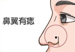 鼻子周围有痣好不好,鼻子上的痣看你是否富贵命 鼻子周围有痣好不好,鼻子上的痣看你是否富贵命