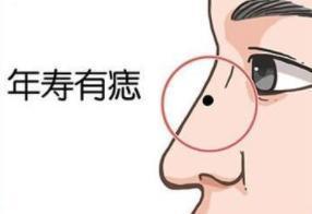 鼻子周围有痣好不好,鼻子上的痣看你是否富贵命 鼻子周围有痣好不好,鼻子上的痣看你是否富贵命