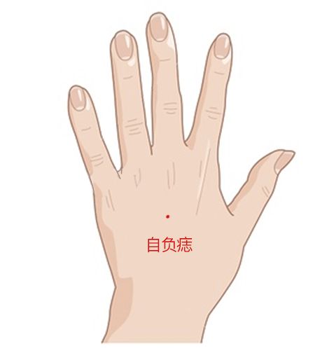 自负痣 自负痣