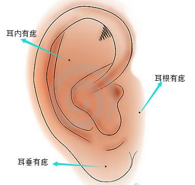 旺夫痣 女人这里长痣,老公年入上百万,儿女都成材 旺夫痣 女人这里长痣,老公年入上百万,儿女都成材