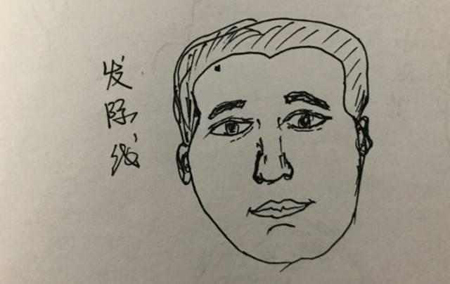 人身上的四处大恶之痣,让人霉运不断,婚姻不稳,一定不能留 人身上的四处大恶之痣,让人霉运不断,婚姻不稳,一定不能留