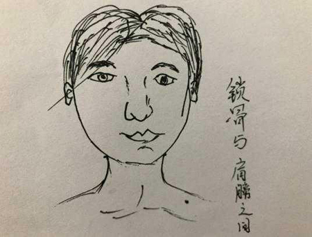 人身上的四处大恶之痣,让人霉运不断,婚姻不稳,一定不能留 人身上的四处大恶之痣,让人霉运不断,婚姻不稳,一定不能留