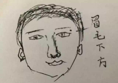 人身上的四处大恶之痣,让人霉运不断,婚姻不稳,一定不能留 人身上的四处大恶之痣,让人霉运不断,婚姻不稳,一定不能留