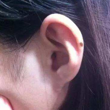 图解面部30种痣的位置与命运 图解面部30种痣的位置与命运