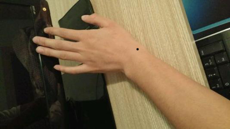 手腕有痣代表什么,手腕背面有痣好吗? 手腕有痣代表什么,手腕背面有痣好吗?