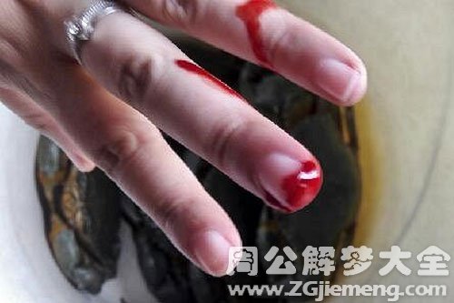 夹手