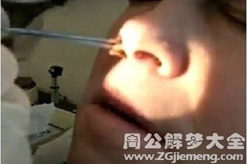 梦见鼻子出虫子