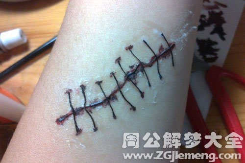 【梦见伤疤】