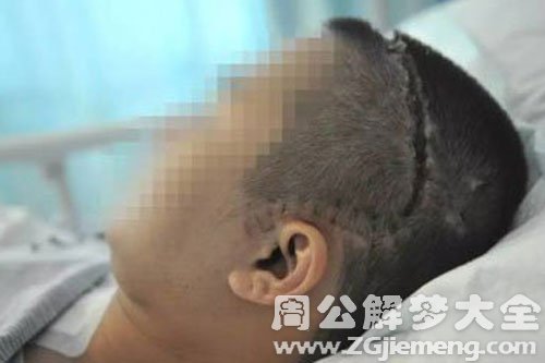 意外